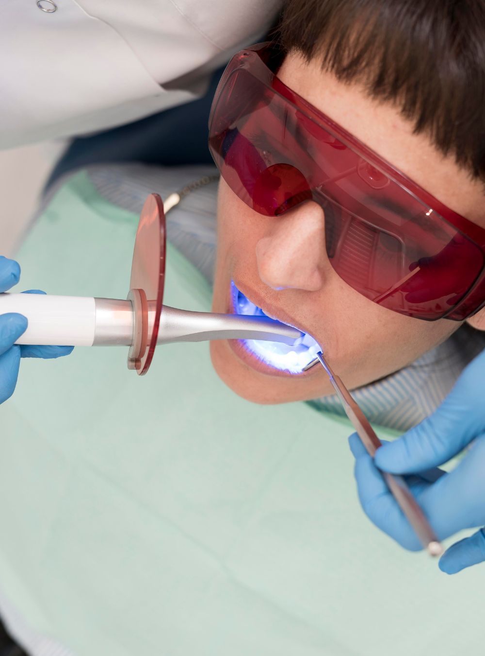 Denti spenti o opachi e perdita di smalto